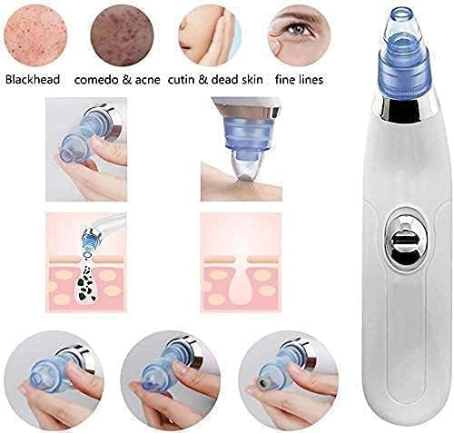 white heads remover