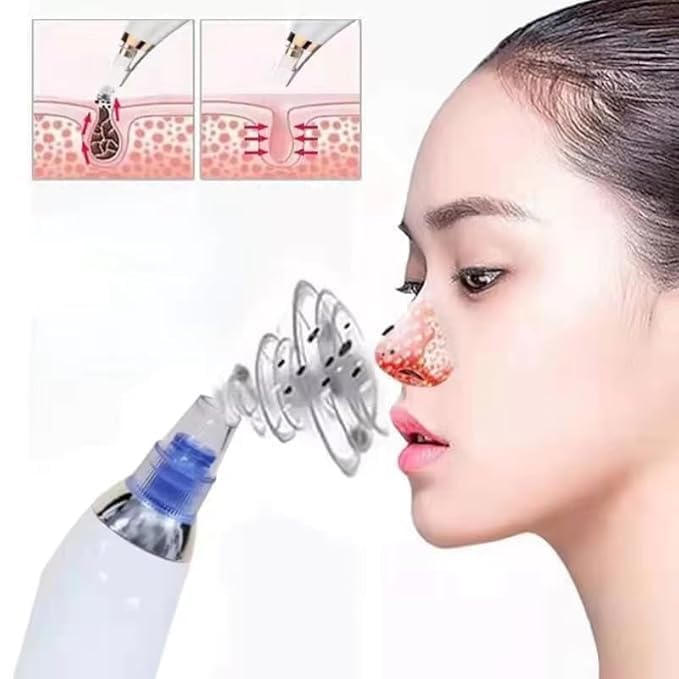 white heads remover