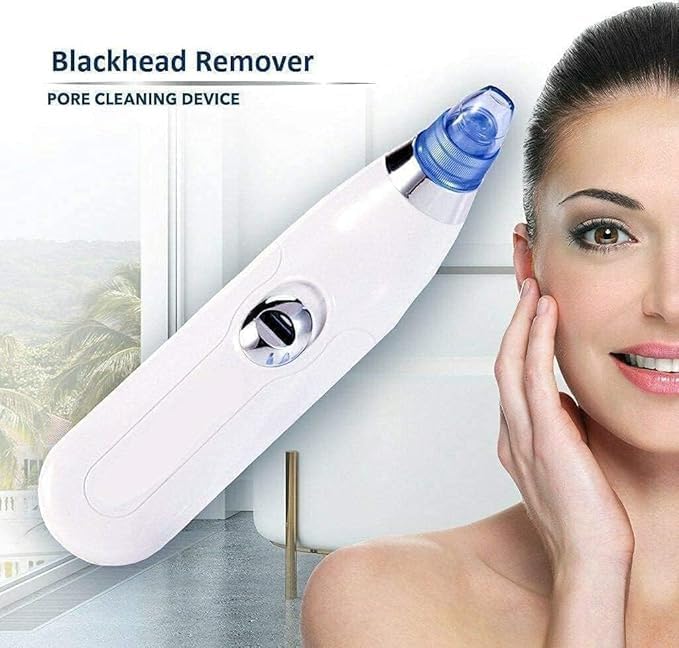 white heads remover